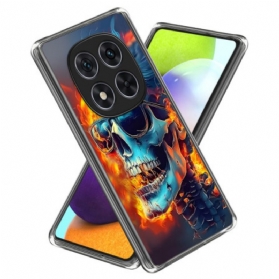 Hülle Xiaomi Redmi Note 14 Pro 4g Flammender Schädel
